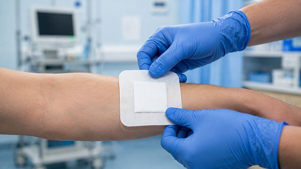 Wound care dressing with border adhesive applied to a patient's forearm.